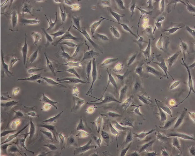 A cell’s-eye view of altered gravity and ageing